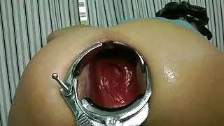 මසුරන් මිතුරෙකු හා ඔහුගේ පන්දු හිස්.